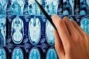 روش جدید درمان تومور‌های مغزی

