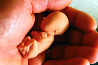 آمار سقط جنین کشور نزدیک به ۳برابر مرگ‌ومیر کرونا!