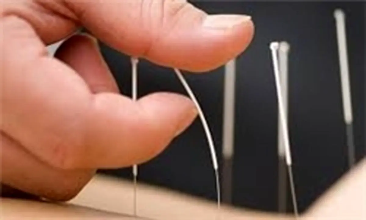 طب سوزنی برای درمان کدام دردها موثر است؟