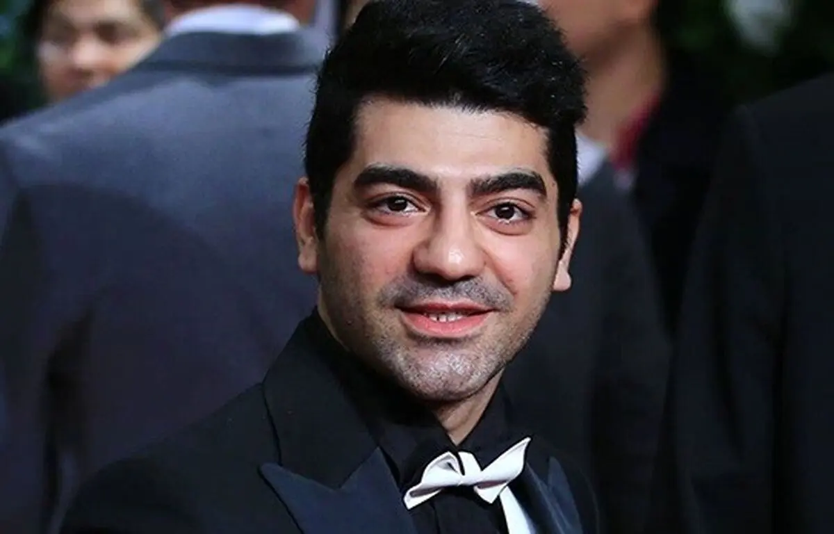 سوختگی شدید صورت کاوه آهنگر /عکس