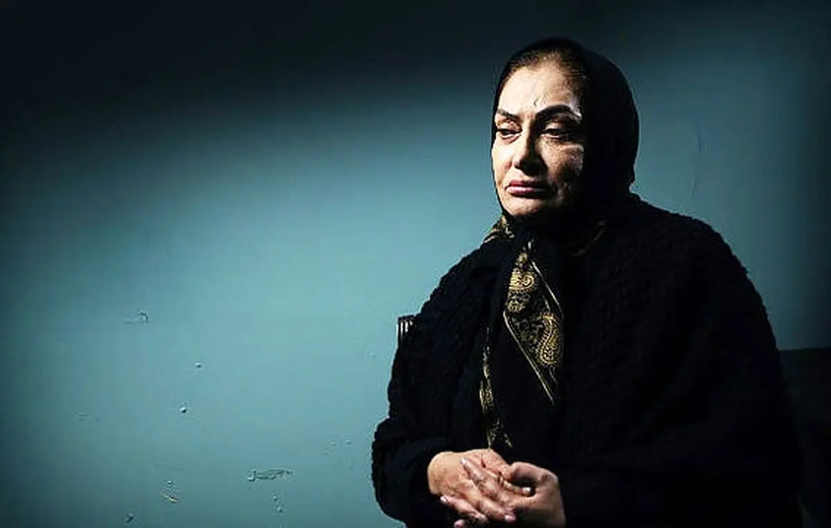 مشکلات جسمانی دلیل غیبت طولانی بازیگر زن مشهور از سینما/ عکس
