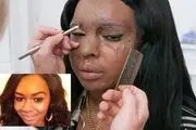 قربانی اسید پاشی نشان شجاعت گرفت