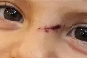 بخیه‌های میلیونی/ جولان بی‌عدالتی در نظام سلامت+سند