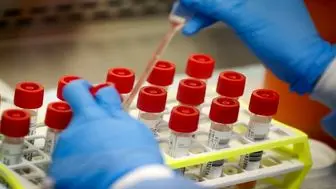 تشخیص سریع آنفلوانزا با آزمایش پی سی آر
