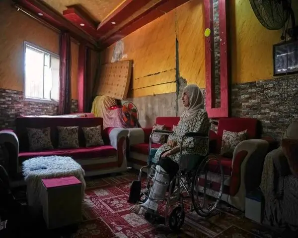 تقلای مجروحان قطع‌ عضو در غزه برای بقا