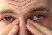چرا چشم به خشکی دچار می‌شود؟