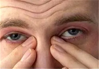 روش های طلایی برای رفع خستگی و تقویت چشم ها