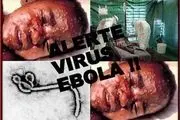 ۵ روش اصلی جلوگیری از ویروس کشنده «ابولا»