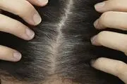 موهای خود را با این ماسک ساده تقویت کنید+ طرز تهیه