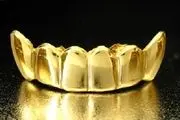  استفاده از روکش طلا براى دندان، در مردان جایز است؟