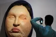 وقوع اسید پاشی در افسریه تهران