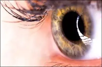 پیش بینی سکته مغزی با بررسی چشم‌ها