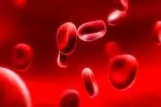 علائم کم خونی چیست؟