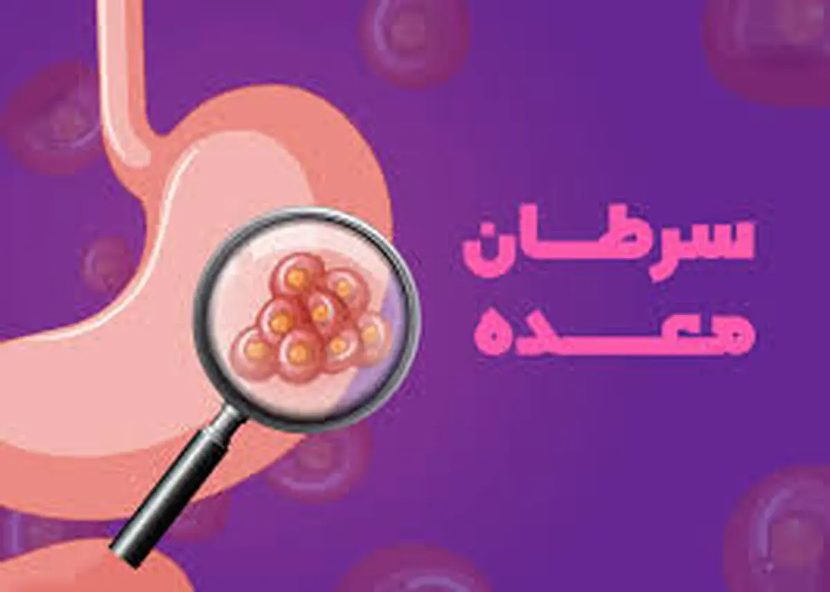 مصرف این ماده غذایی محبوب به شدت سرطان‌زاست!