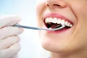 پیشگیری از بیماری‌های مرگبار با بهداشت دهان و دندان