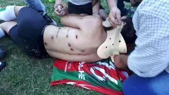 حمله وحشیانه پلیس به فوتبالیست های آرژانتینی/عکس