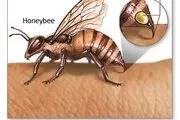 وقتی حشرات نیش می‌زنند چه باید بکنیم؟!
