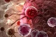 تشخیص سرطان پروستات با آزمایش خانگی