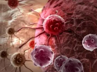 فاکتور‌های پرخطر ابتلا به سرطان خون را بشناسید
