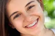 ارتودنسی دندان چیست؟