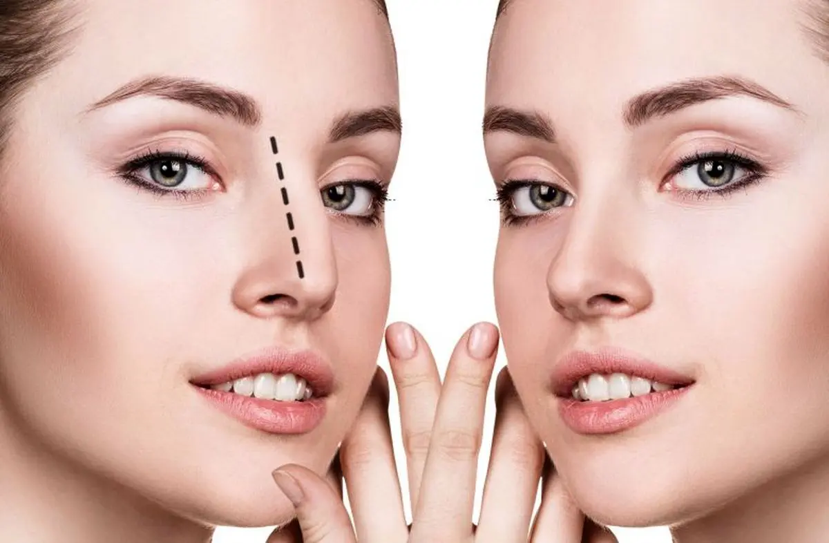 عطش وحشتناک دختران ایرانی برای جراحی زیبایی