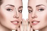 ممنوعیت عمل زیبایی در ایام کرونایی