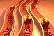 نشانه‌های هشداردهنده مصرف بیش از حد چربی + جزئیات
