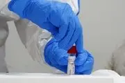 پاسخ ساده به یک سوال درباره بیولوژیک بودن کرونا