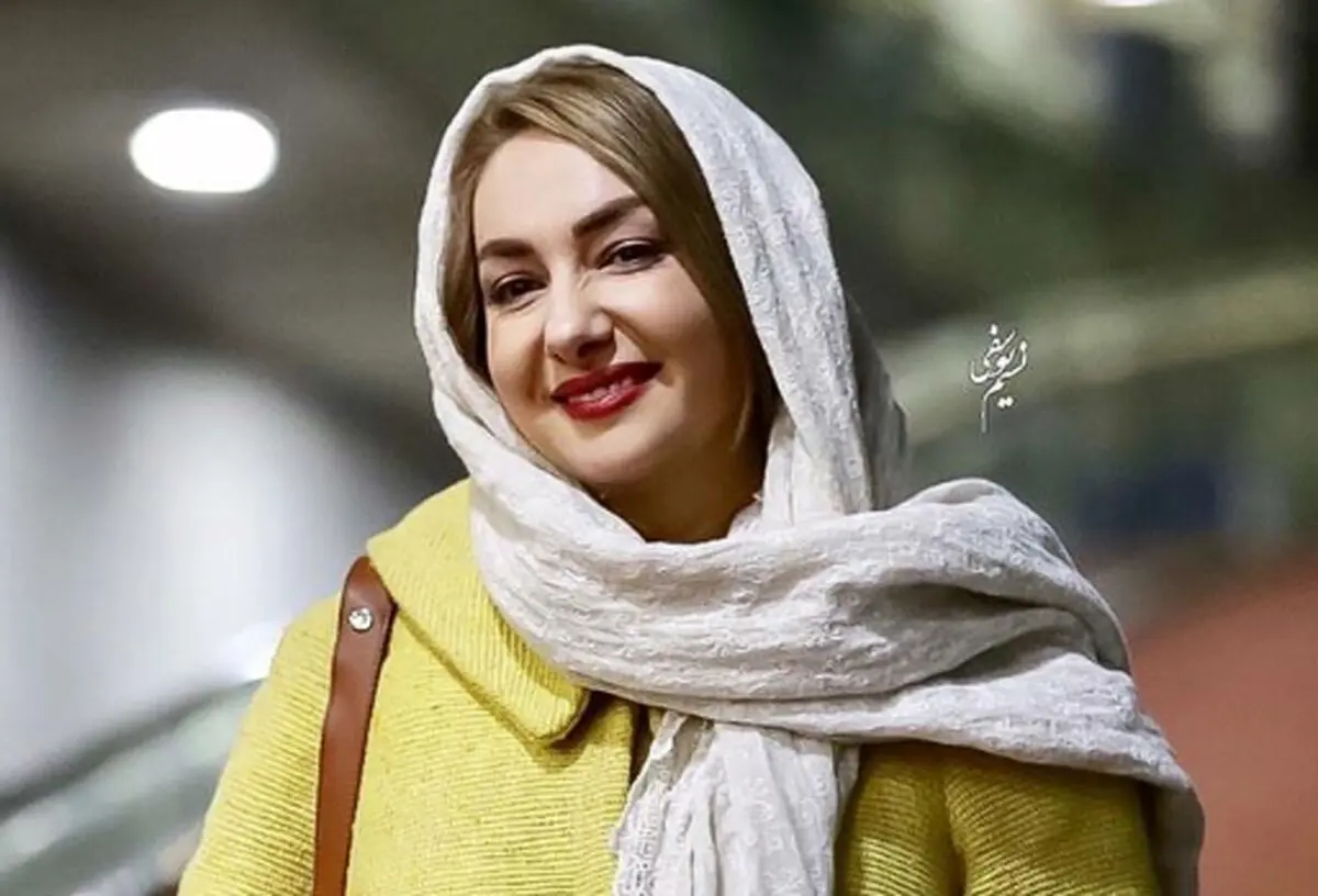 هانیه توسلی وقتی که چاق بود! /عکس