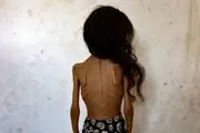 کاریکاتور تلخ نشریه ایتالیایی در واکنش به گرسنگان غزه