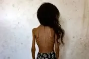 کاریکاتور تلخ نشریه ایتالیایی در واکنش به گرسنگان غزه
