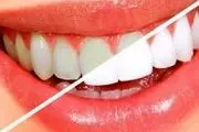 ترفندهایی که دندان‌ را سفید می‌کند