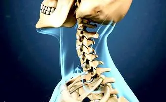 علایم آسیب های دیسک بین مهرهای در ناحیه گردن