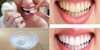 دندان‌های زرد را با این 4 ترفند سفید کنید