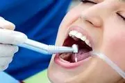 درباره پر کردن دندان بیشتر بدانید