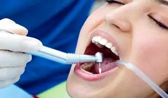 درباره پر کردن دندان بیشتر بدانید