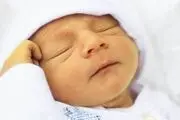 از چه راه‌هایی می‌توان از زردی نوزادها در زمان بارداری پیش‌گیری کرد؟