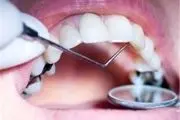 خبرهای خوش دندانپزشکی از زبان وزیر بهداشت