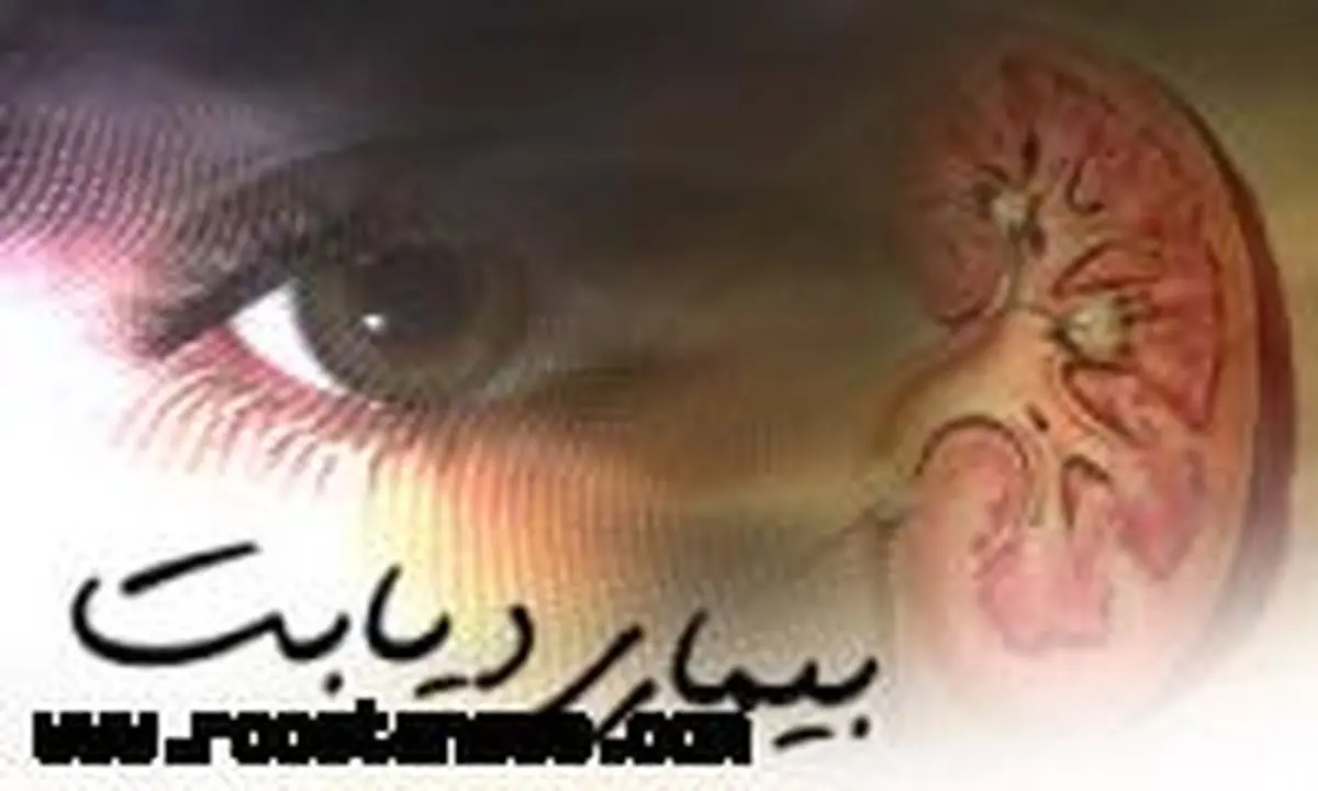 ۵۶۳ نفر مبتلا به دیابت در روستاهای اسدآباد شناسایی شد