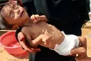 خطر مرگ جمعی در کمین میلیون‌ها کودک یمنی