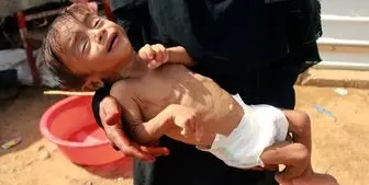 هر ۵ ثانیه یک کودک یمنی جان خود را از دست می‌دهد