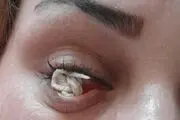 حادثه حیرت انگیز در قوه بینایی بانوی اصلاندوزی