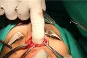 انجام ۶۵ عمل جراحی شکاف لب و سرطان‌های صورت