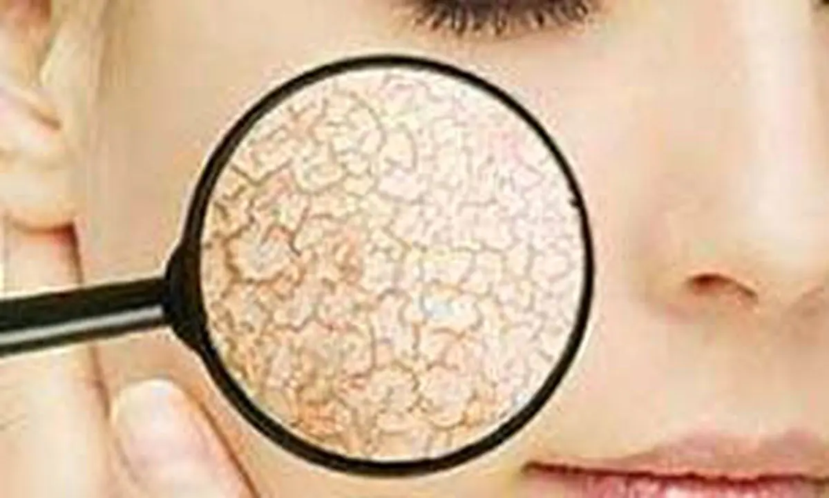 ترفندهایی برای حل مشکلات پوستی با مواد غذایی در خانه