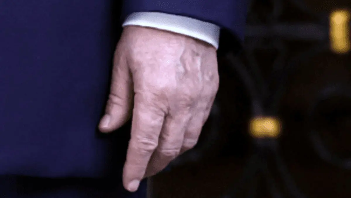 شایعات در مورد سلامتی ترامپ،‌ دوباره بالا گرفت