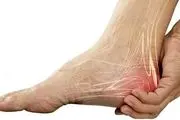دلایل درد در ناحیه پاشنه چپ پا و راه‌های درمان


