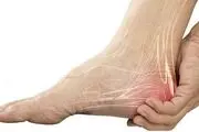 دلایل درد در ناحیه پاشنه چپ پا و راه‌های درمان

