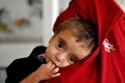 بحران گرسنگی؛ تهدیدی برای کودکان افغانستان در ۲۰۲۴