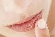 ۶ راه برای درمان ترک خوردگی لب