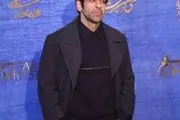 بازیگر کرگدن تغییر چهره داد /  عکس